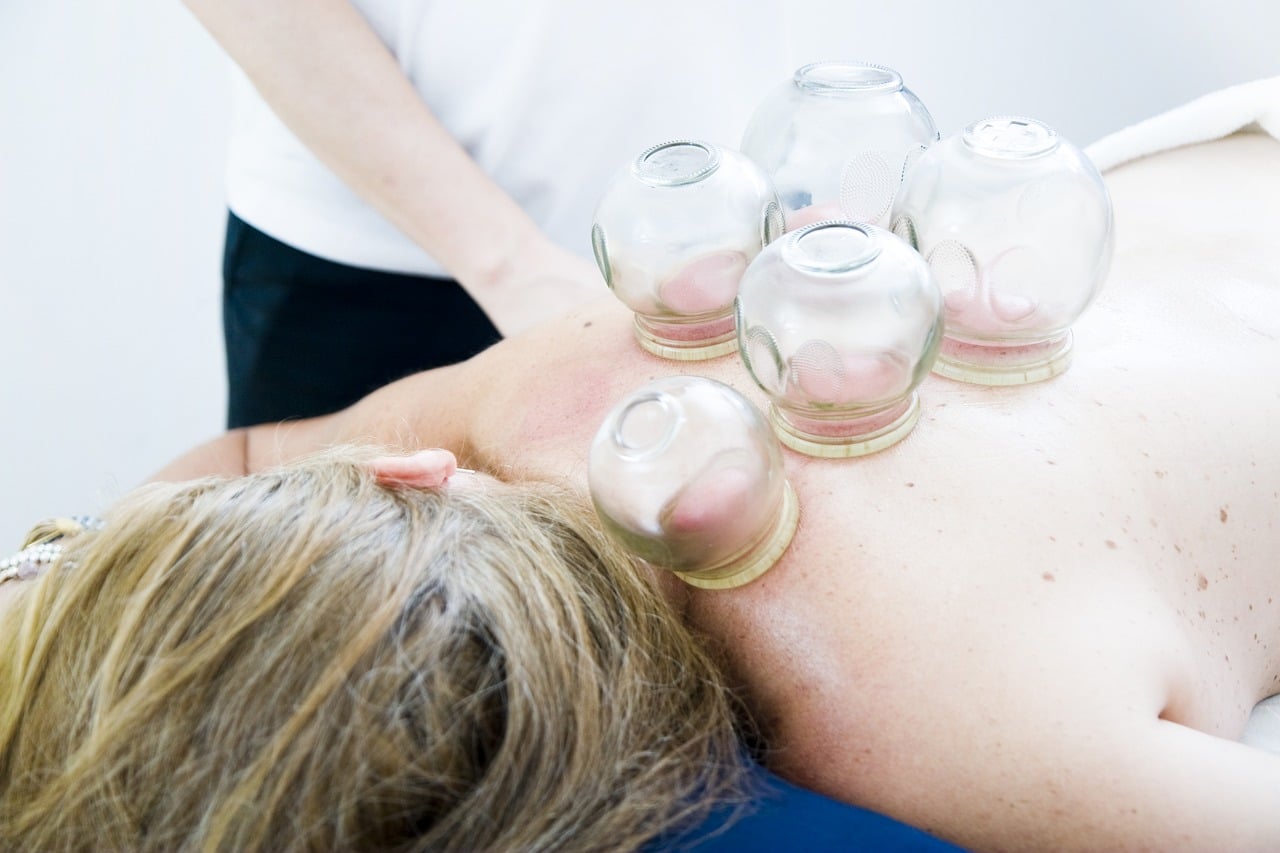 cupping therapy, cupping massage, massage, alternative medicine, chinese traditional medicine, cupping therapy, cupping therapy, cupping therapy, cupping therapy, cupping therapy